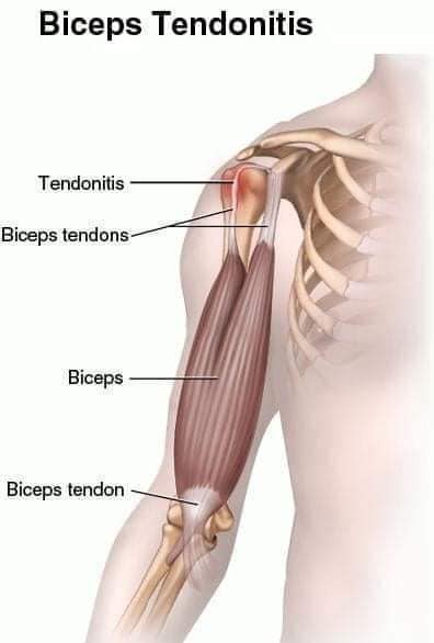 muscular-system65.jpg